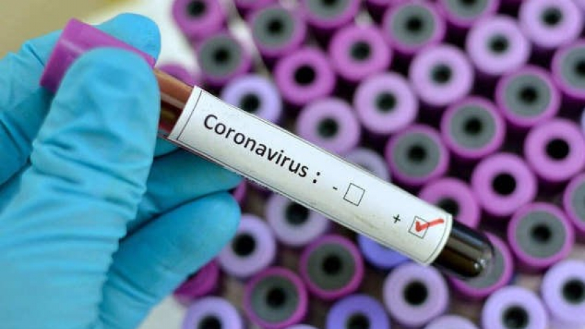 Nakažených koronavirem je v Čechách již dvanáct