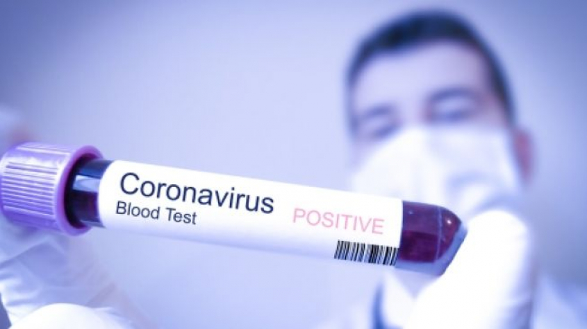 Koronavirem se nakazilo již 18 lidí. Podle vlády je aktuálně v Itálii asi 16.500 Čechů