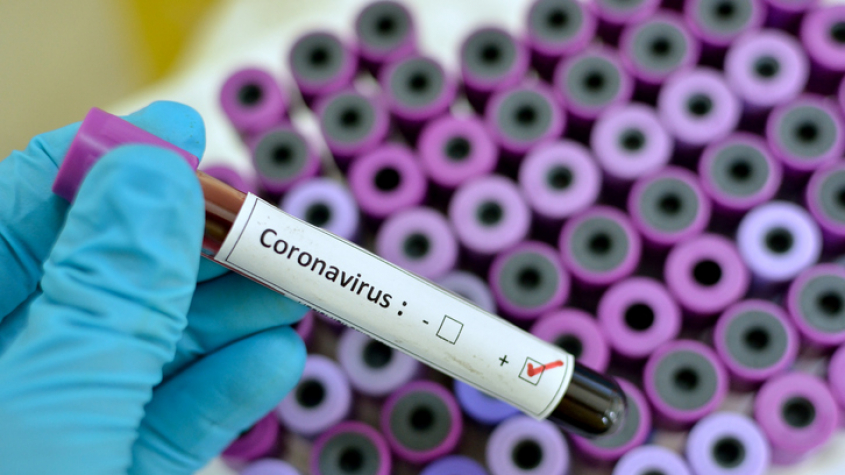 Počet nakažených koronavirem stoupl na 189