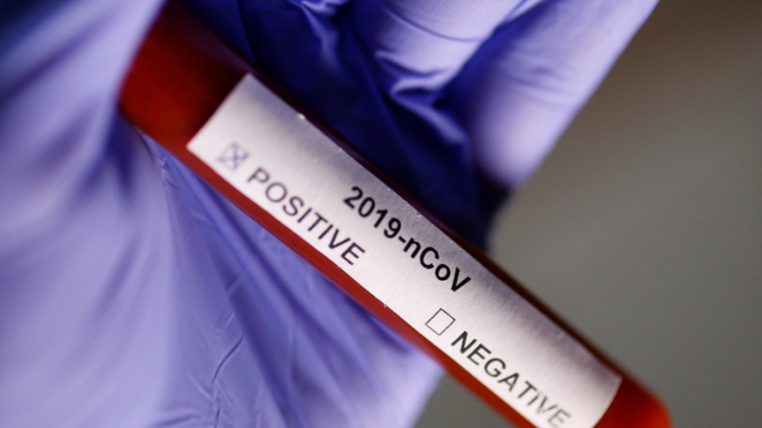 Česko má 434 případů koronaviru, Středočeský kraj eviduje 48 nakažených