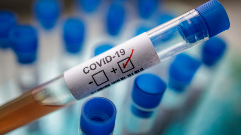 V Česku zemřelo s nemocí COVID-19 již 39 pacientů