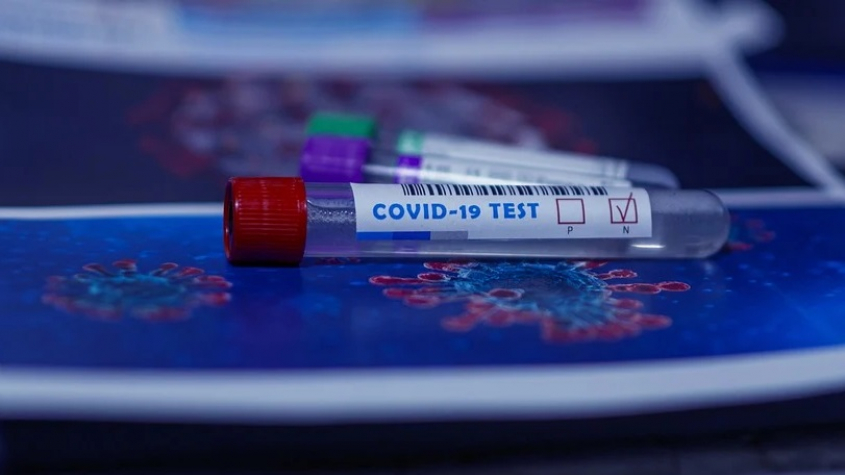V sobotu v Česku přibylo 239 případů koronaviru