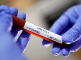 V Česku je 61 případů nákazy novým koronavirem
