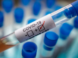V Česku zemřelo s nemocí COVID-19 již 39 pacientů
