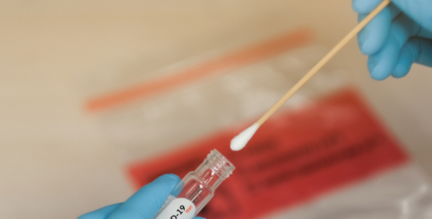 S covid-19 zemřelo 170 lidí, 979 se vyléčilo, nakažených je 6437