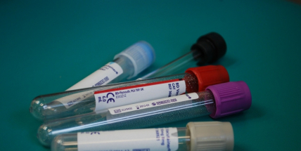 Příbramská záchranná služba testuje novou pojízdnou laboratoř