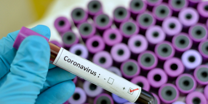 Počet nakažených koronavirem stoupl na 189