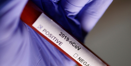 Česko má 434 případů koronaviru, Středočeský kraj eviduje 48 nakažených