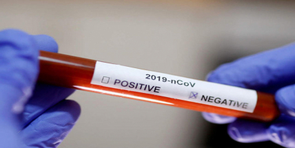 Příbramsko se prozatím drží! Koronavirem je nakažena stále jen jedna osoba