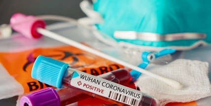 Příbramsko hlásí dalšího nakaženého koronavirem. Celkem onemocnělo osm osob