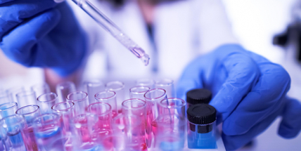 Česko má 995 případů koronaviru. Středočeský kraj je v těsném závěsu za Prahou