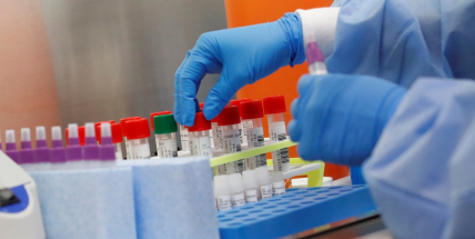 Lidí s koronavirem v Česku přibylo na 1165, šest se vyléčilo, jeden zemřel