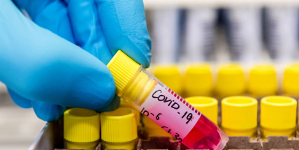 Česko mělo k půlnoci 1287 potvrzených případů nákazy koronavirem. Sedmý pacient se vyléčil