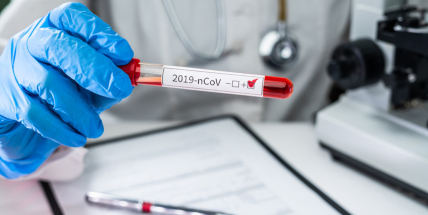 V Česku zemřela pacientka s COVID-19, měla další zdravotní problémy