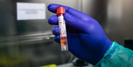 Koronavirem se v Česku nakazilo už 1654 lidí, šest zemřelo