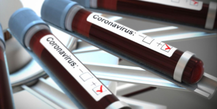 V Čechách přibylo nakažených za jeden den 291. Příbramsko hlásí 16 potvrzených případů Covid-19