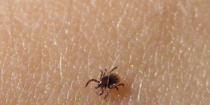 Příbramská nemocnice vyšetřuje klíšťata na přítomnost borreliózy do 24 hodin