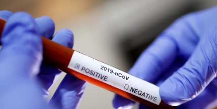 Lidí s nemocí covid-19 přibylo ve středu o 295. Nakazilo se již 280 dětí