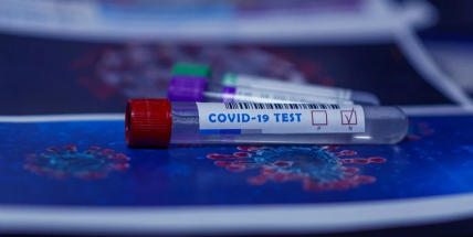 V sobotu v Česku přibylo 239 případů koronaviru