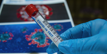 Vědci: Tisíce lidí v ČR v době epidemie umírají zbytečně