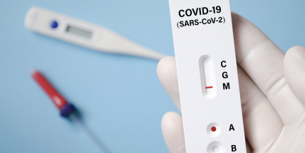 Povinné testy by měly platit i pro malé firmy a úřady