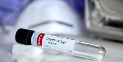 Vláda nařídila povinné testování i pro firmy od 10 do 49 pracovníků