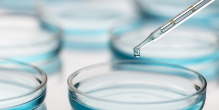 Nedělních 197 nakažených je nejméně za druhý víkendový den od 23. srpna