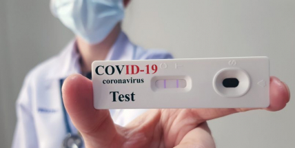 Ministerstvo navrhne neuznávat jako potvrzení negativní testy