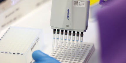 Ředitel laboratoře: Variantou omikron se promoří celá populace, už to nejde zastavit