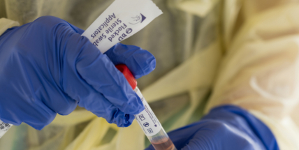 Epidemie covidu příští týden vyvrcholí, může být až 80.000 nákaz denně