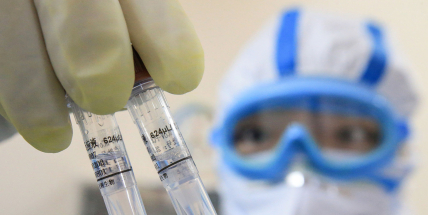 V sobotu přibylo 8220 nakažených, za epidemii jich je přes 3,5 milionu