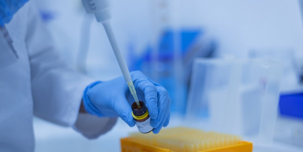 V pátek počet případů covidu klesl pod 10.000, před týdnem jich bylo o 4600 více