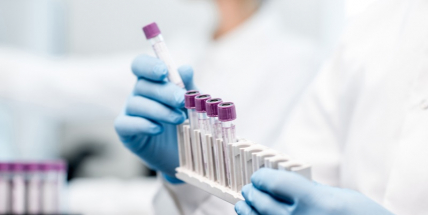 Ve čtvrtek v ČR přibylo 8081 nakažených, zájem o očkování klesá