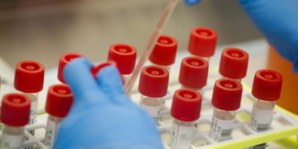 Nových případů covidu bylo v úterý 10.715, znovu více než před týdnem