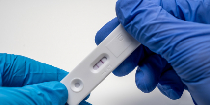 V pátek přibylo 8705 případů covidu, o 350 více než před týdnem