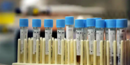 Ve čtvrtek přibylo 3303 nakažených covidem, nejmíň za všední den za půl roku