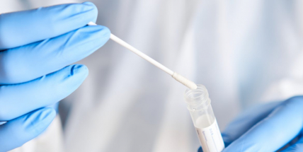 Epidemie covidu dál zpomaluje, v neděli testy odhalily 750 nových případů