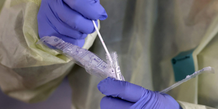 V pondělí přibylo 3441 případů covidu, mezitýdenní pokles pokračuje