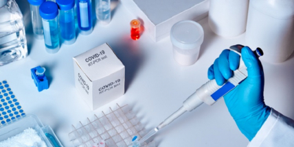 V úterý opět zpomalil nárůst případů covidu, ale bylo i méně testovaných