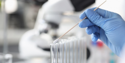 Šíření covidu v ČR zpomaluje, za posledních sedm dní zemřelo s nákazou 127 lidí