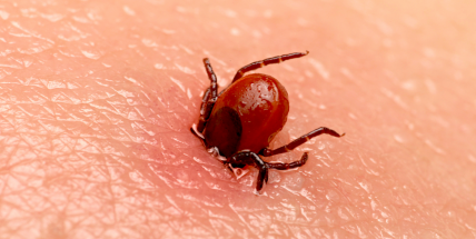 Aktivita klíšťat je vysoká až mimořádná. Umíte se nezvaného hosta správně zbavit?