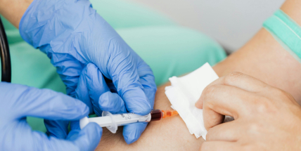 Žloutenka na vzestupu. Středočeský kraj řešil stovky případů